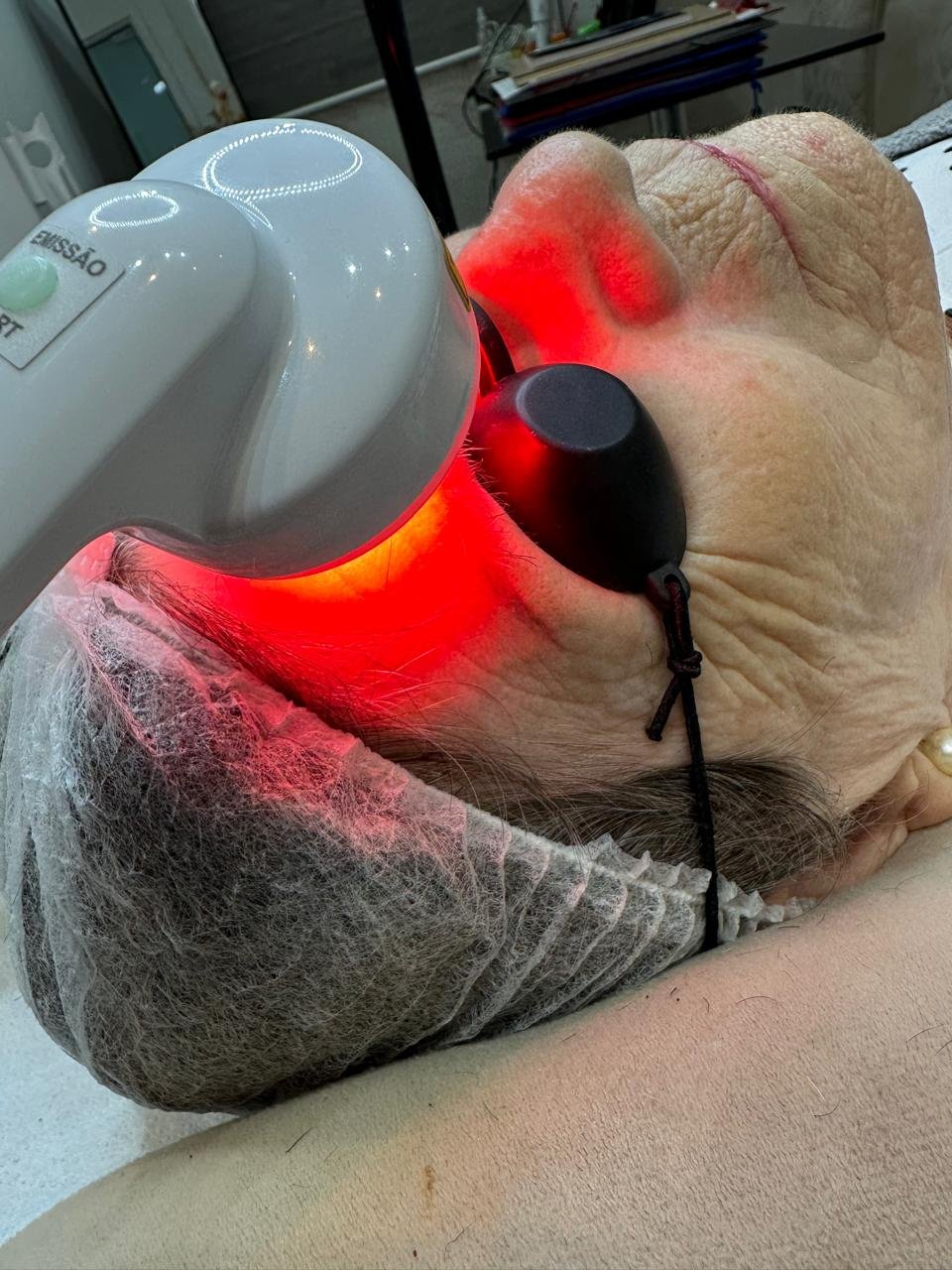 Procedimento de limpeza de pele